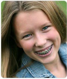 L’appareil dentaire permet aux jeunes adolescents de retrouver une dentition bien droite.