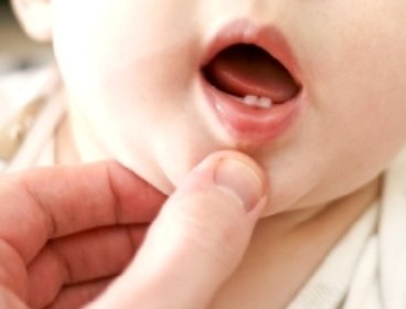 Comment faire pour que bébé ait de bonnes dents ? 