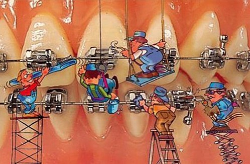 Quelques faits concernant l’hygiène dentaire et l’orthodontie 