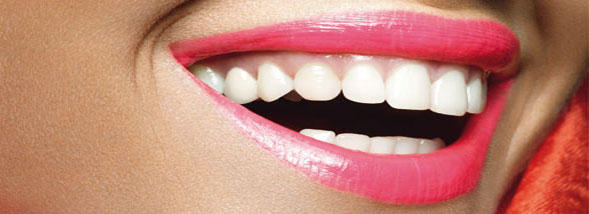 sourire - dental Health